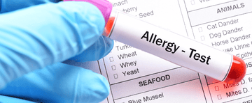 Scientists reveal the UK’s biggest allergy